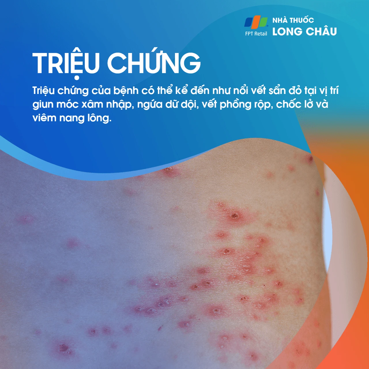 Ấu trùng da di chuyển 2