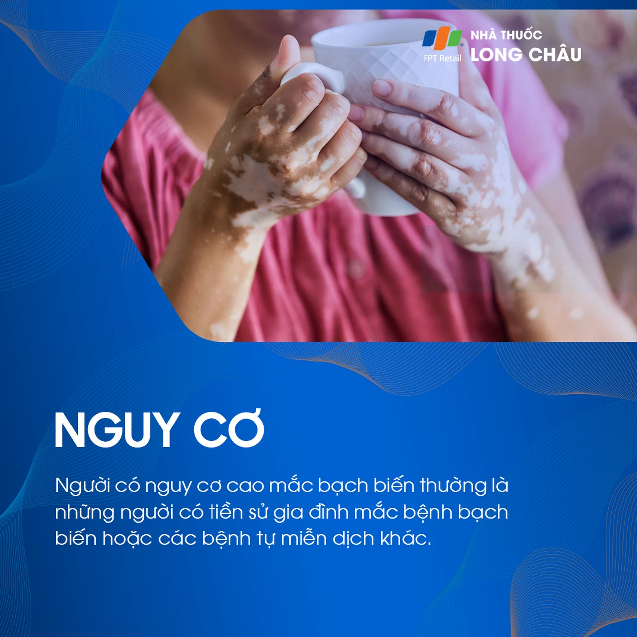 Người có tiền sử gia đình bị bạch biến hoặc bệnh tự miễn có nguy cơ cao mắc bệnh