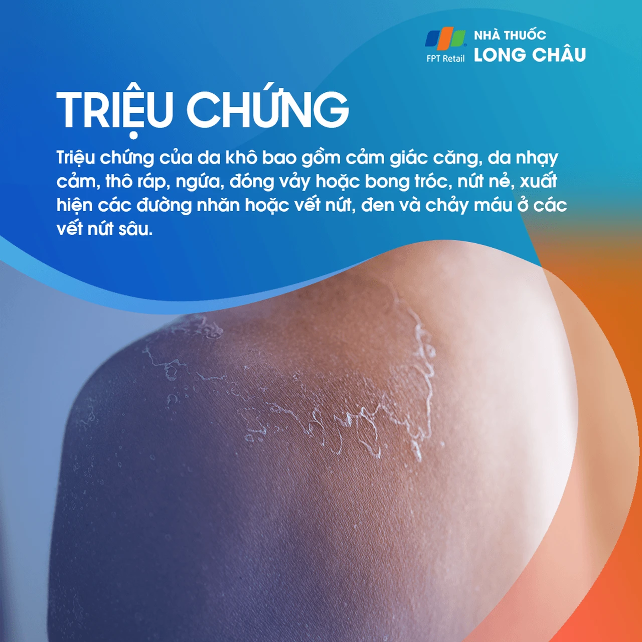 Da căng, thô ráp, ngứa, bong tróc, nứt nẻ, có thể chảy máu ở vết nứt sâu