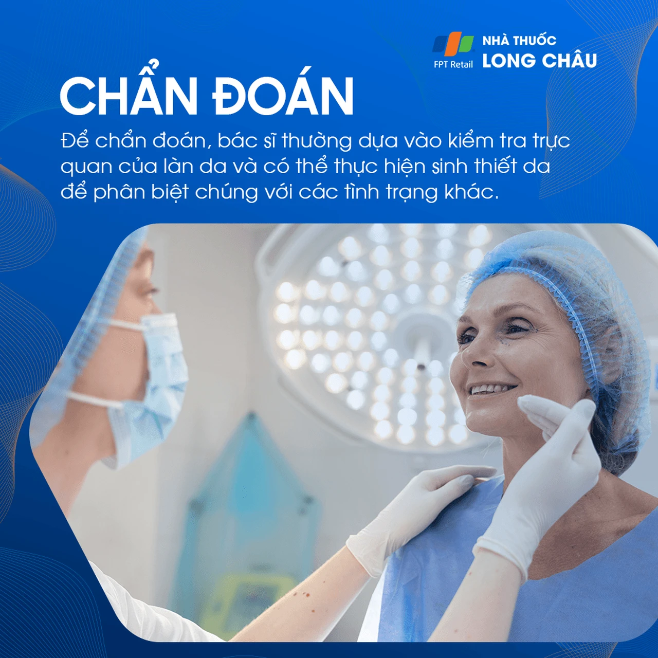 Cách chẩn đoán đồi mồi thường dựa vào khám ngoại khoa da liễu và đánh giá lâm sàng về mức độ và mẫu phân bố của các vết sắc tố