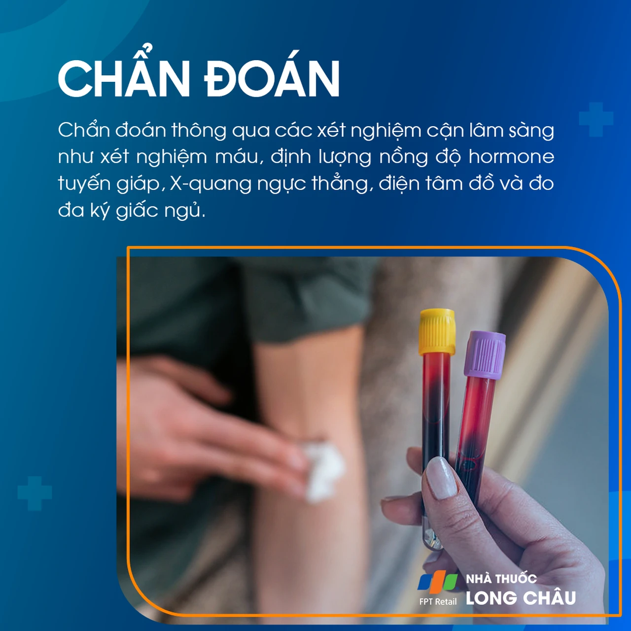 Đổ mồ hôi trộm 5