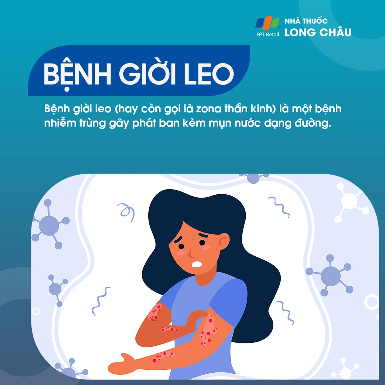 Giời leo là gì? Những vấn đề cần biết về bệnh giời leo