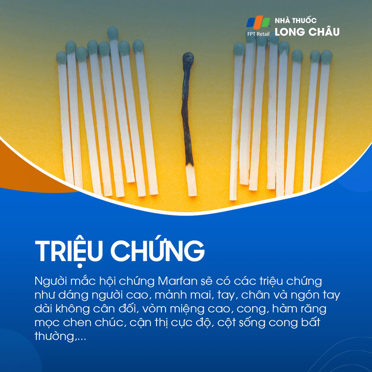 Hội chứng Marfan 2