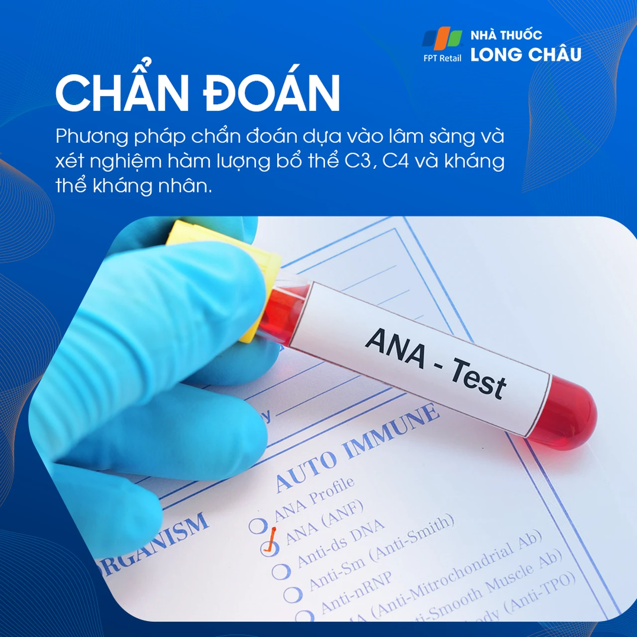 Xét nghiệm ANA Test là phương pháp chẩn đoán lupus ban đỏ