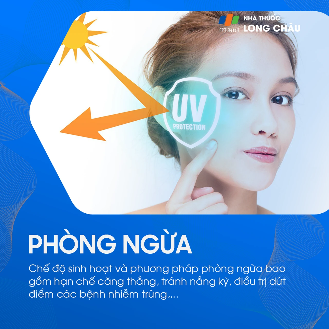 Tránh nắng là biện pháp phòng ngừa lupus ban đỏ