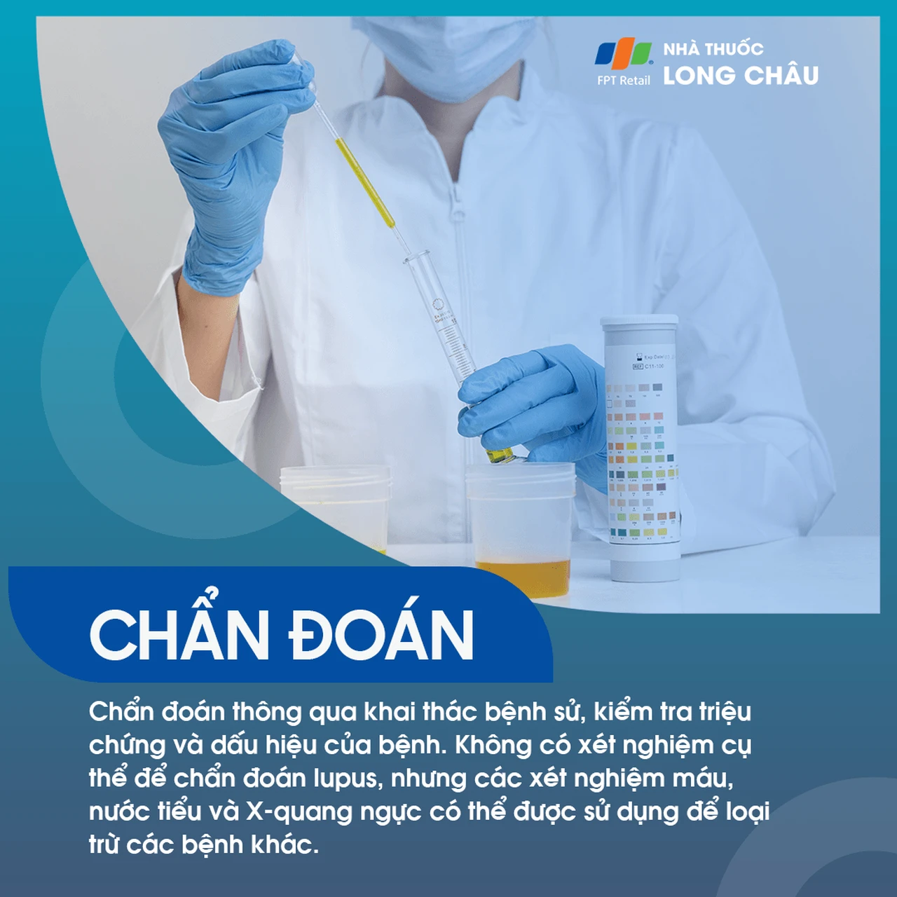 Lupus Ban Đỏ Hệ Thống 5