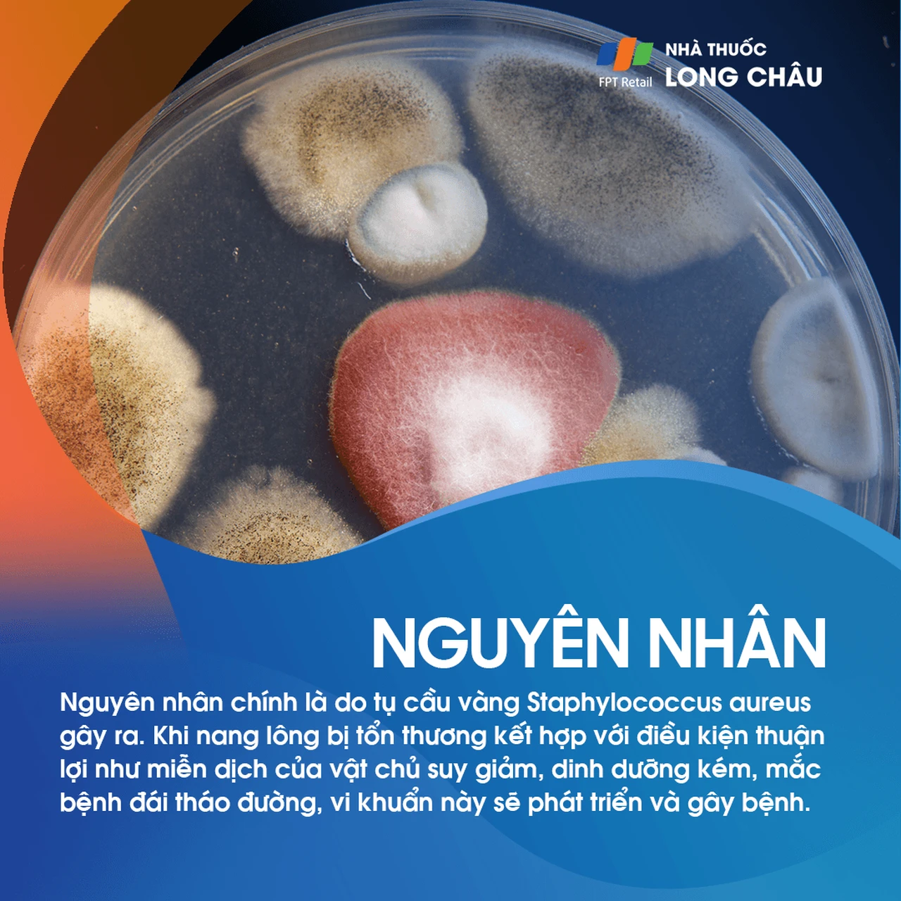Nguyên nhân hình thành mụn nhọt thường liên quan đến nhiễm trùng vi khuẩn