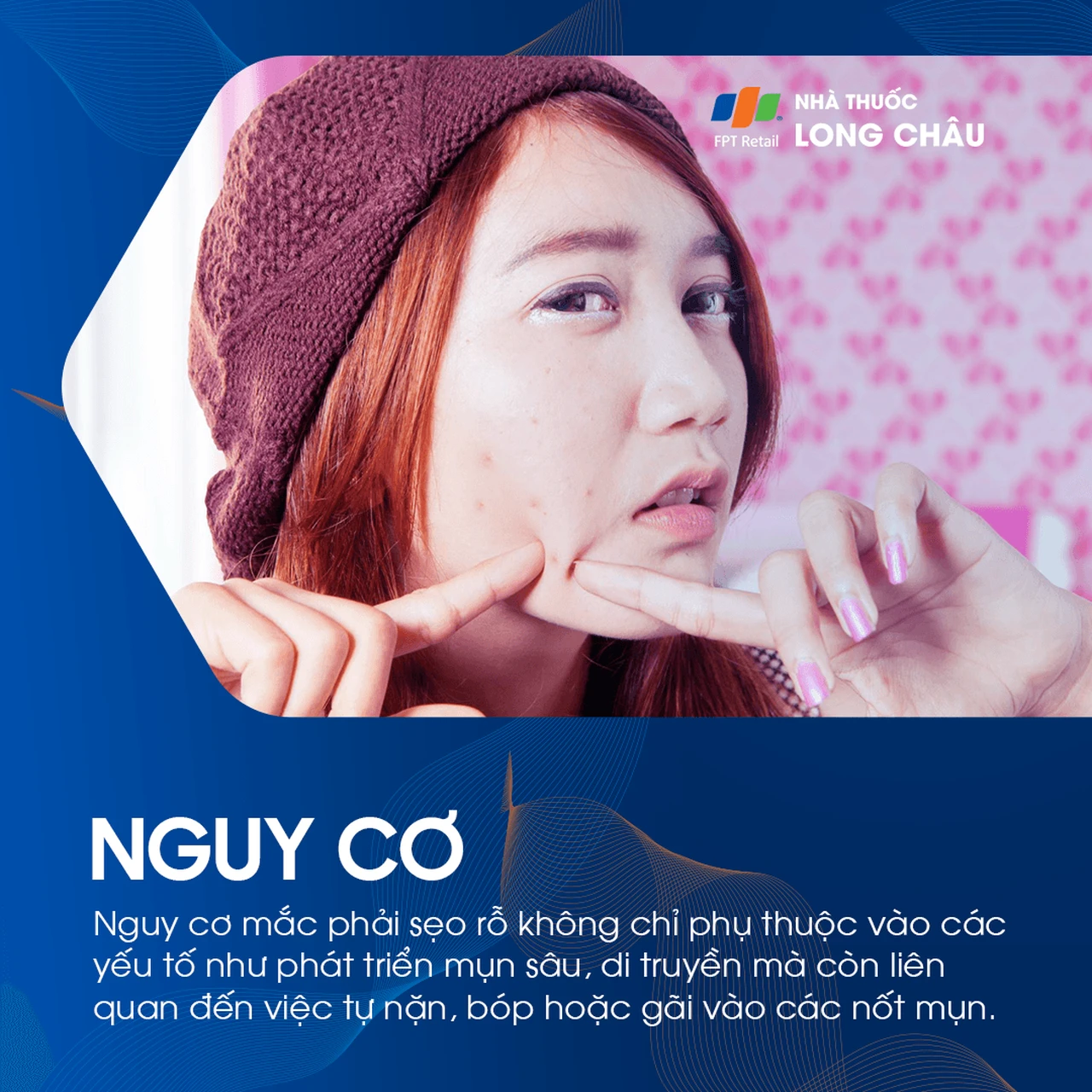 Không điều trị kịp thời, sẹo rỗ có thể trở thành biến chứng lâu dài, ảnh hưởng đến thẩm mỹ và tâm lý của bệnh nhân