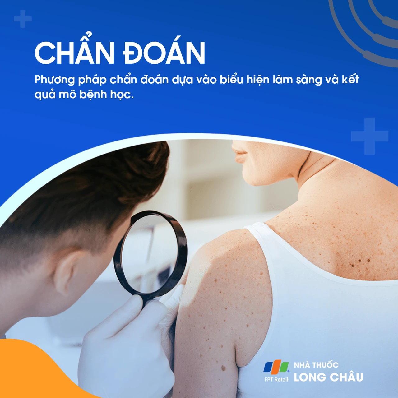 Ung Thư Tế Bào Hắc Tố 5