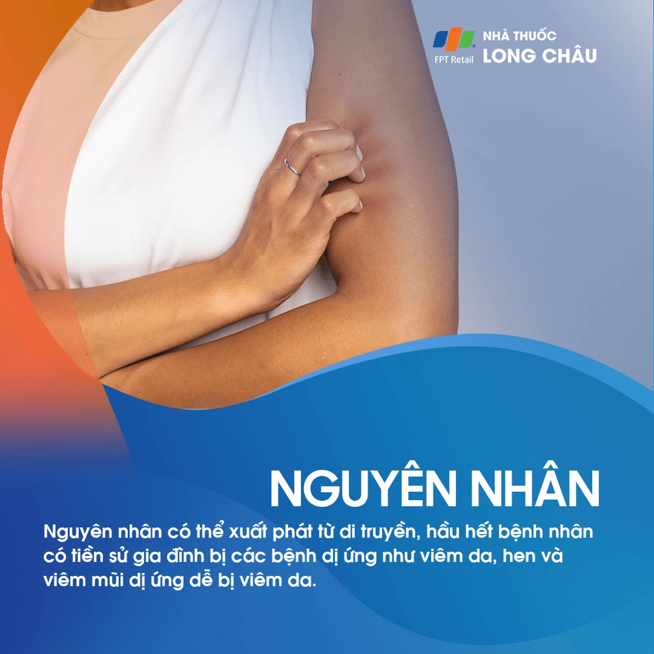 Nguyên nhân viêm da cơ địa liên quan đến yếu tố di truyền và dị ứng