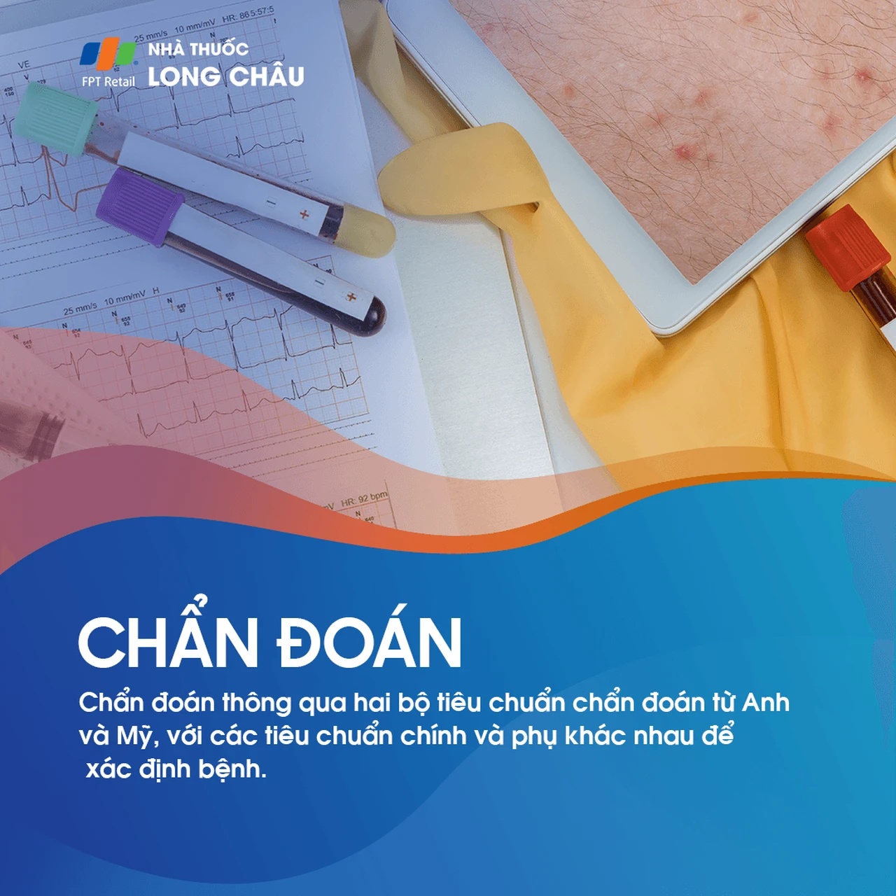 Chẩn đoán viêm da cơ địa