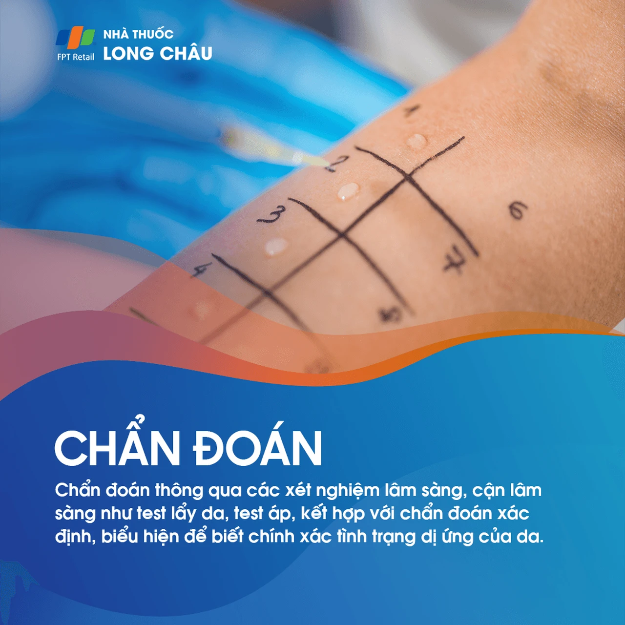 Viêm Da Dị Ứng 6