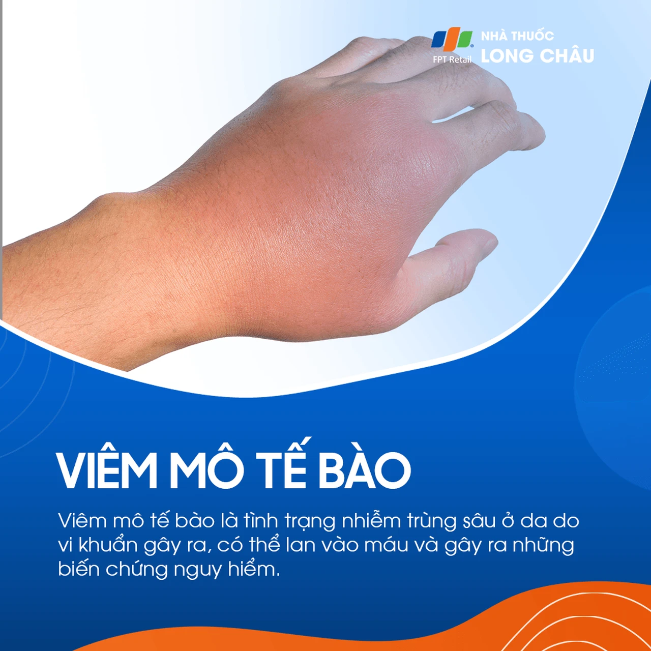 Viêm Mô Tế Bào 1