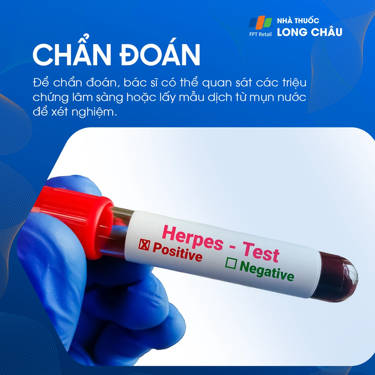 Cách chẩn đoán bệnh Herpes môi