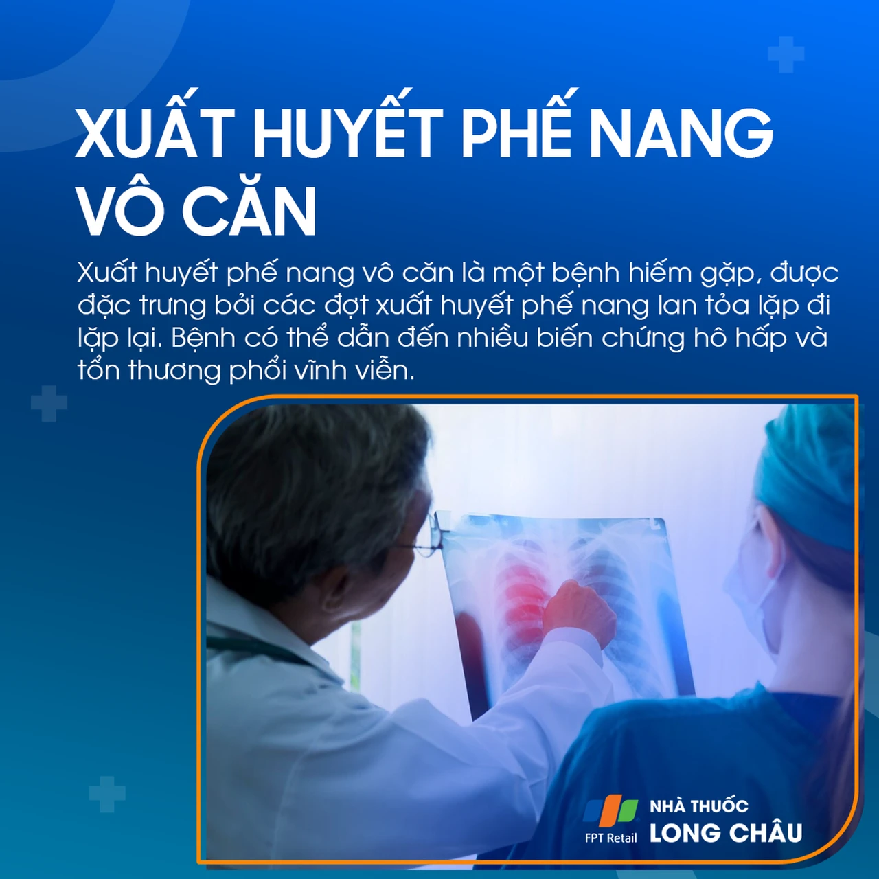 Xuất huyết phế nang 1