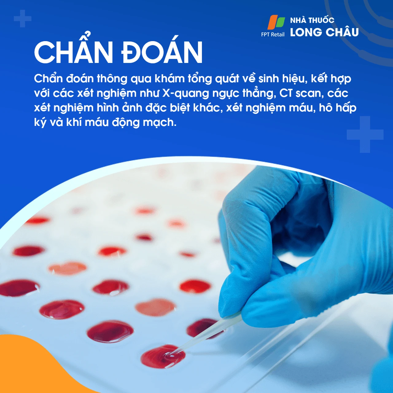 Chẩn đoán hụt hơi