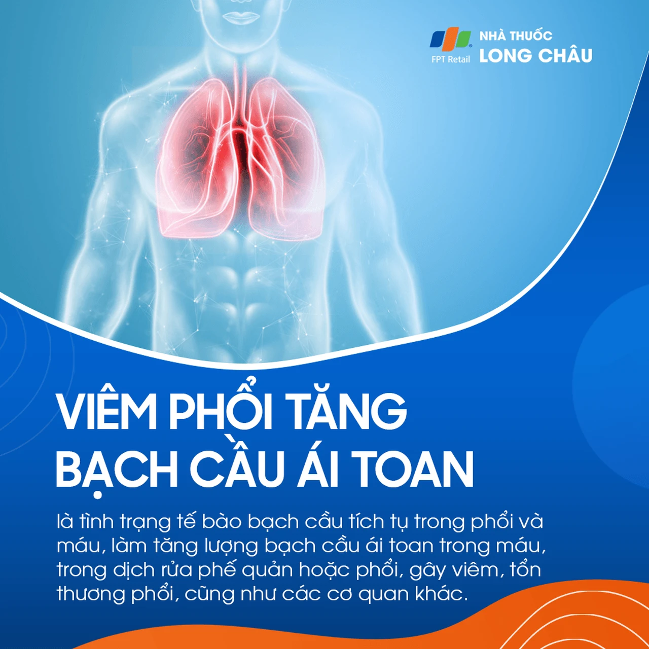 Viêm phổi tăng bạch cầu ái toan 1