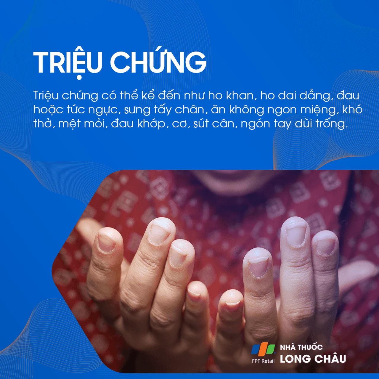 Xơ phổi vô căn 2