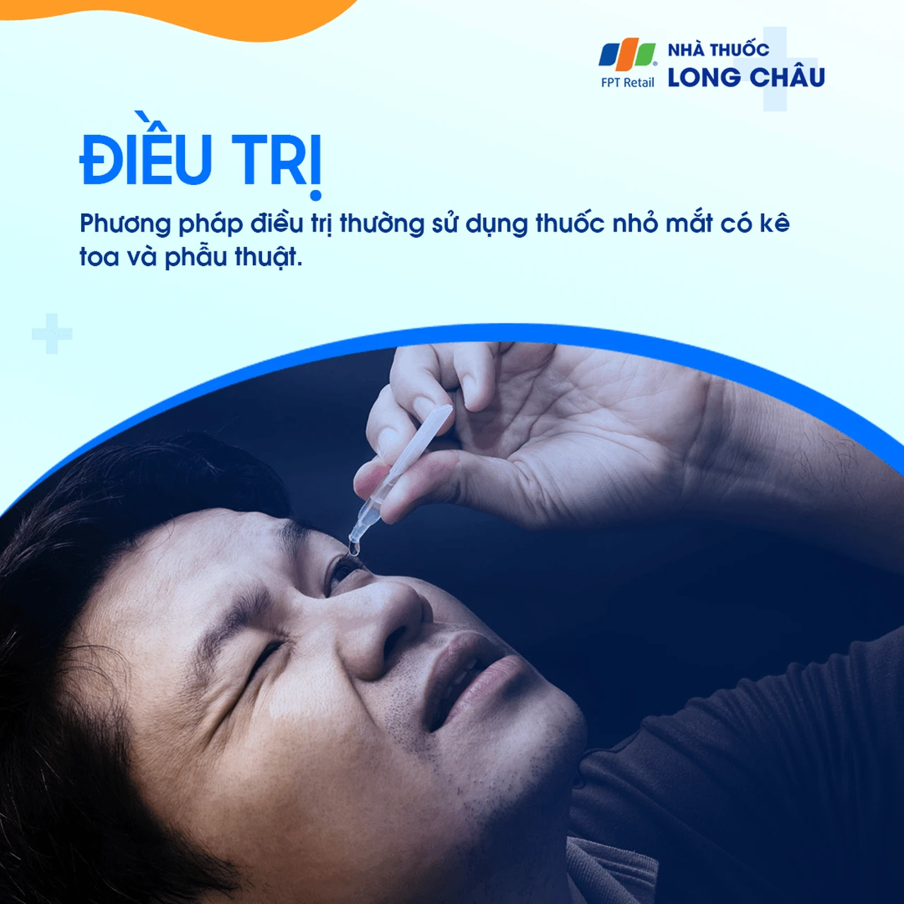 thuốc nhỏ mắt dùng trong điều trị bệnh tăng nhãn áp, giúp giảm áp lực bên trong mắt