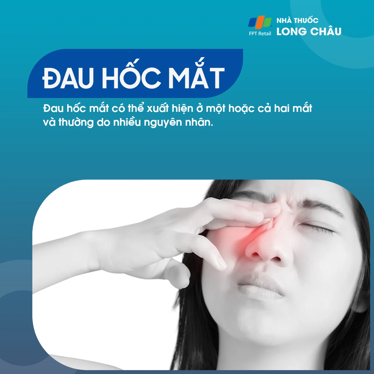 Đau hốc mắt có thể xuất hiện ở một hoặc cả hai mắt do nhiều nguyên nhân khác nhau, cần được theo dõi và điều trị kịp thời