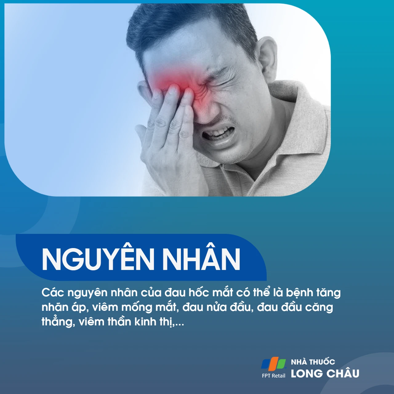 Đau hốc mắt có thể do tăng nhãn áp, viêm màng bồ đào, đau nửa đầu, viêm thần kinh thị giác hoặc căng thẳng kéo dài