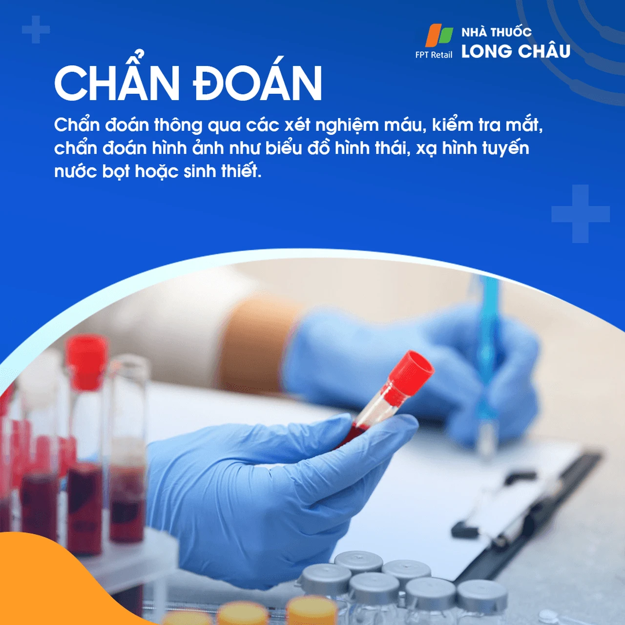 Hội chứng Sjogren 5