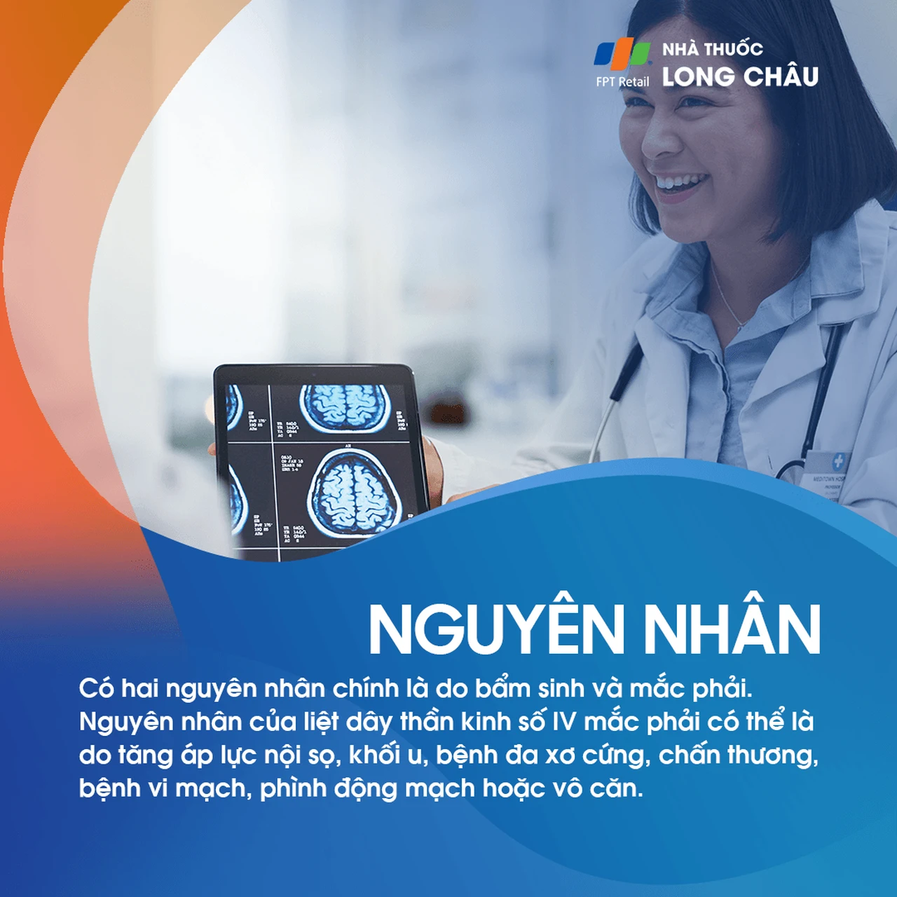 Liệt dây thần kinh số IV 3