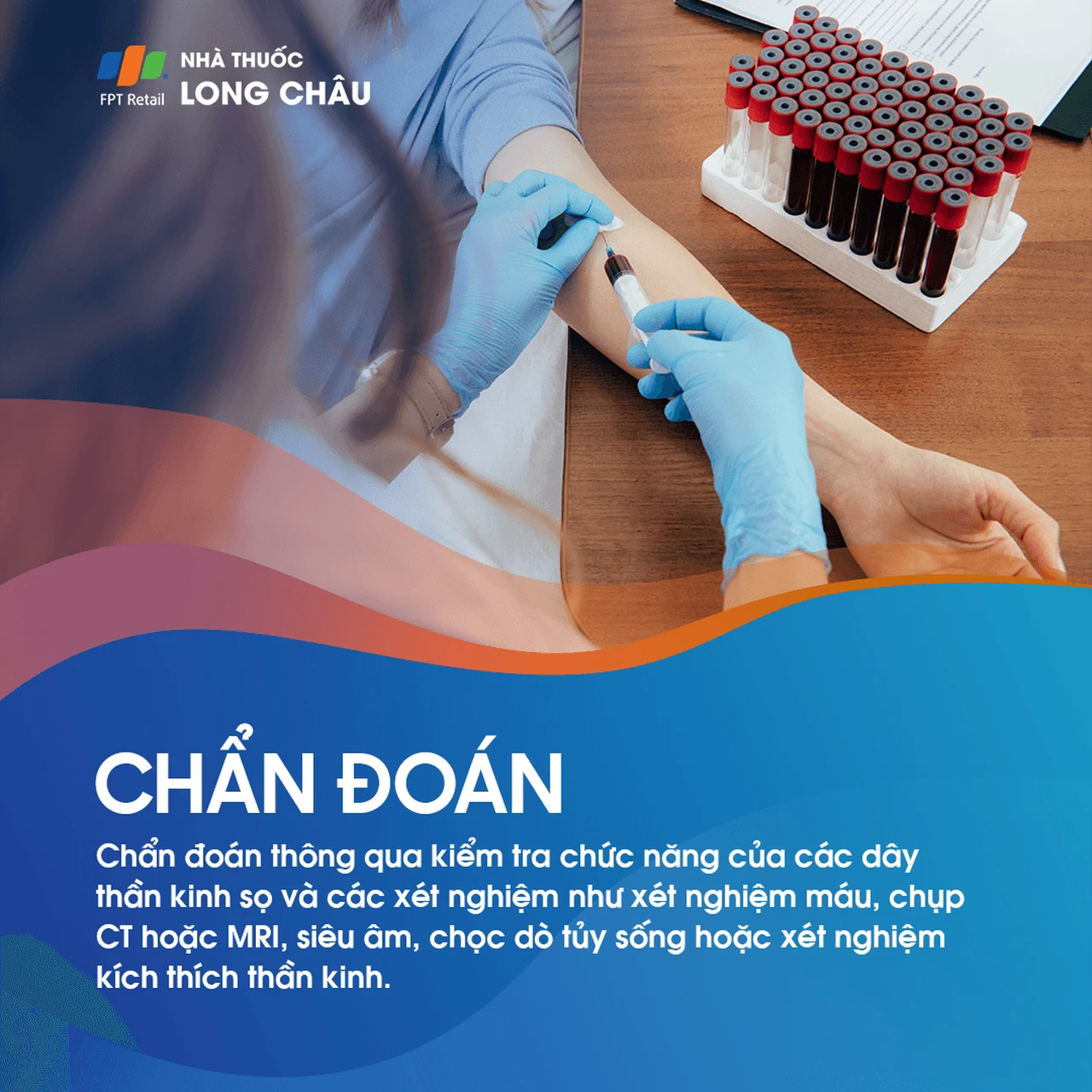 Liệt dây thần kinh số 5