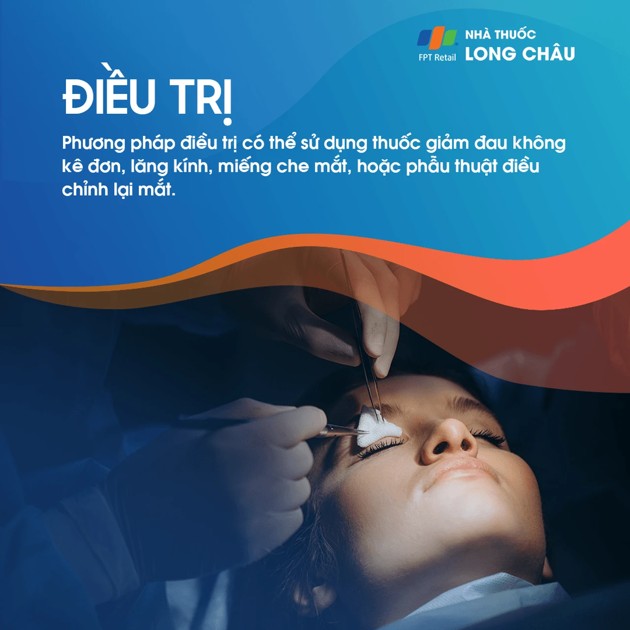 Liệt dây thần kinh số IV 6