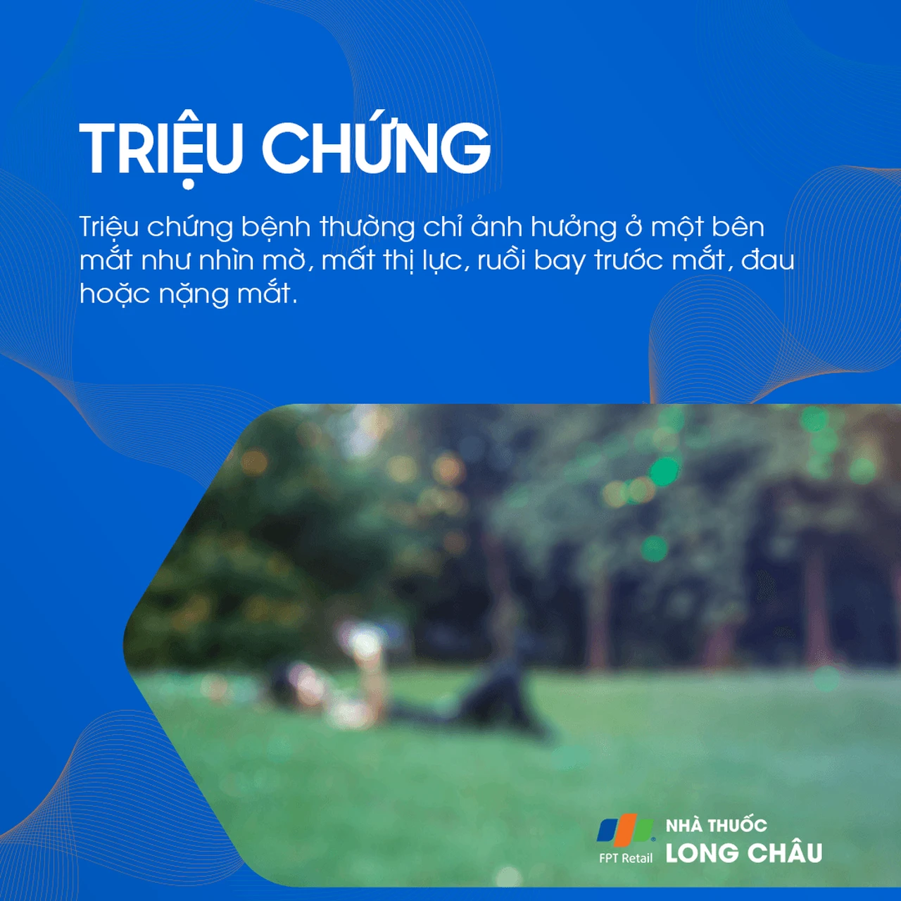 Tắc tĩnh mạch võng mạc 2