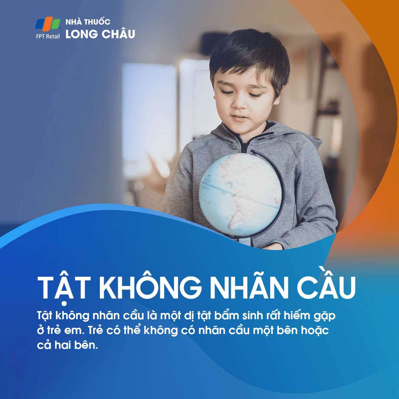 Tật không nhãn cầu 1