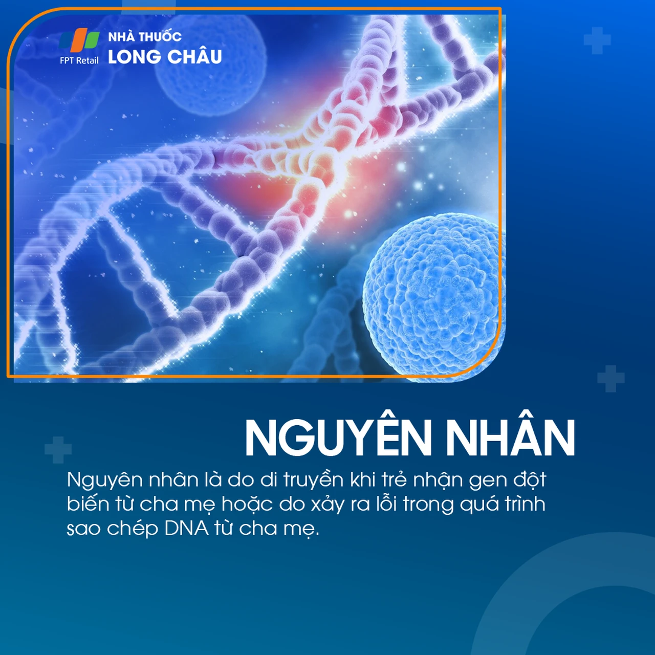 U nguyên bào võng mạc 4