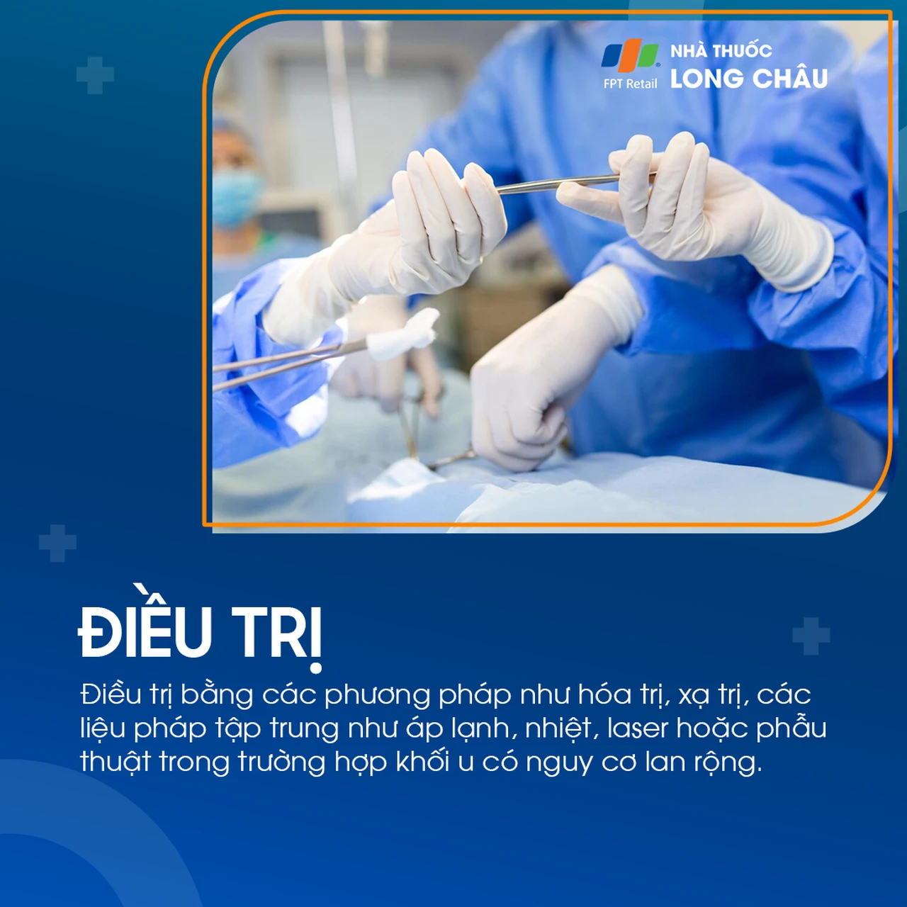 U nguyên bào võng mạc 7