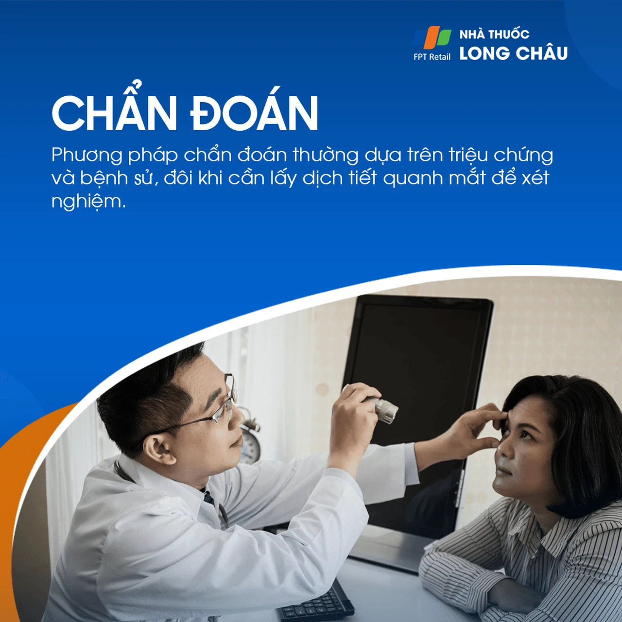 Viêm kết mạc mắt 5