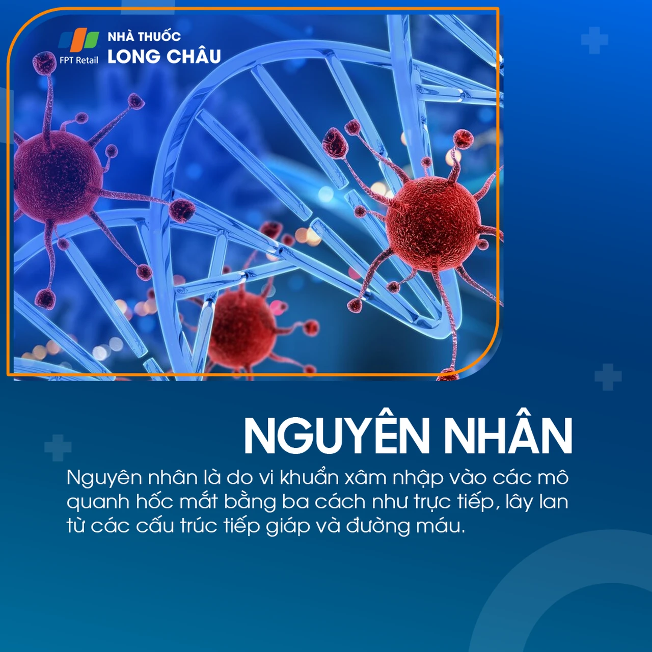 Viêm mô tế bào quanh hốc mắt 3