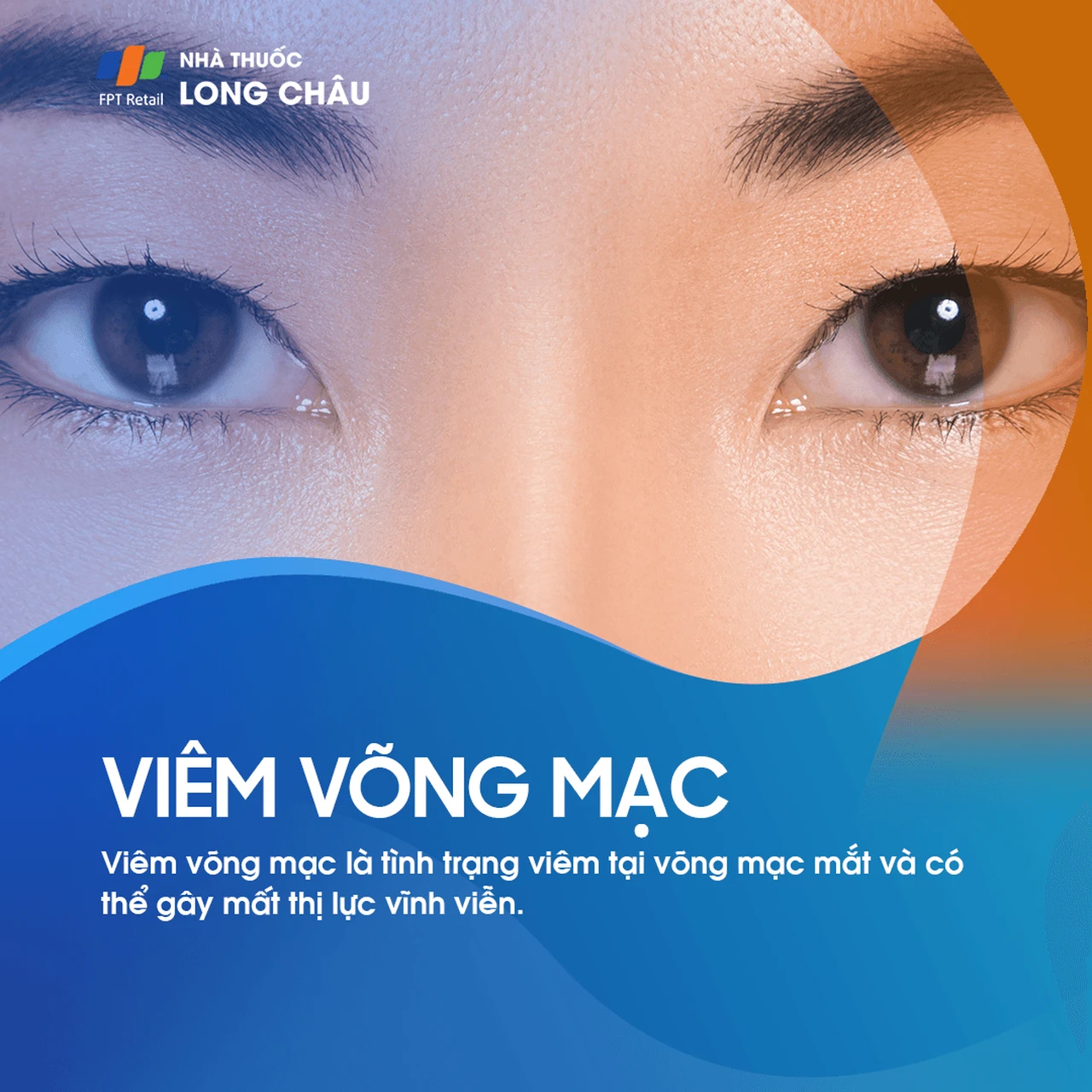 Viêm võng mạc 1