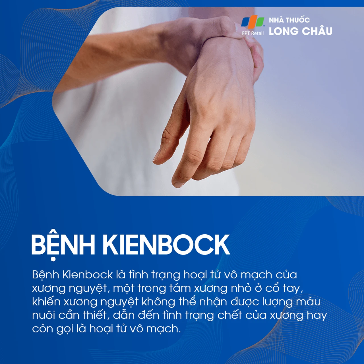 Bệnh kienbock 1