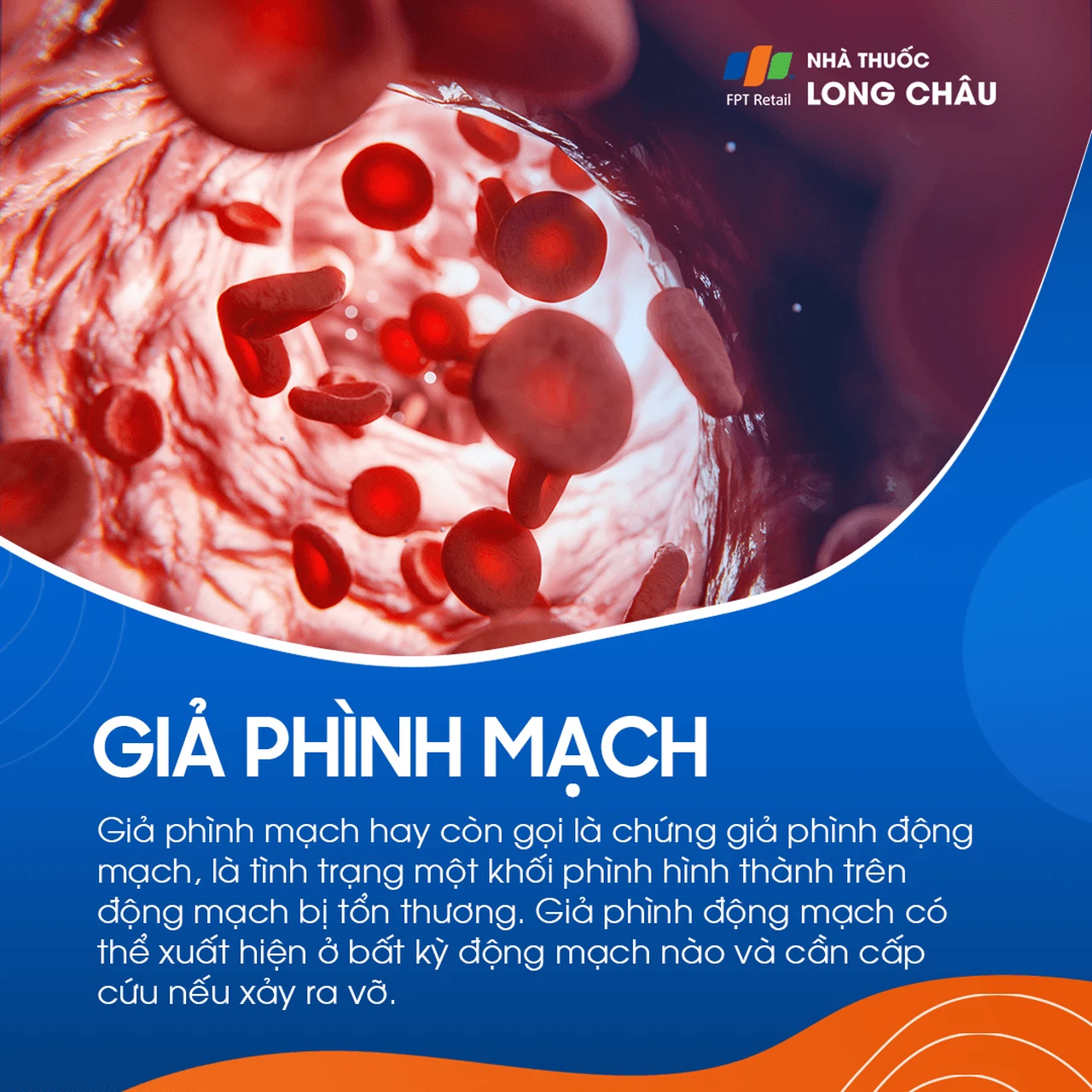 Giả phình mạch 1
