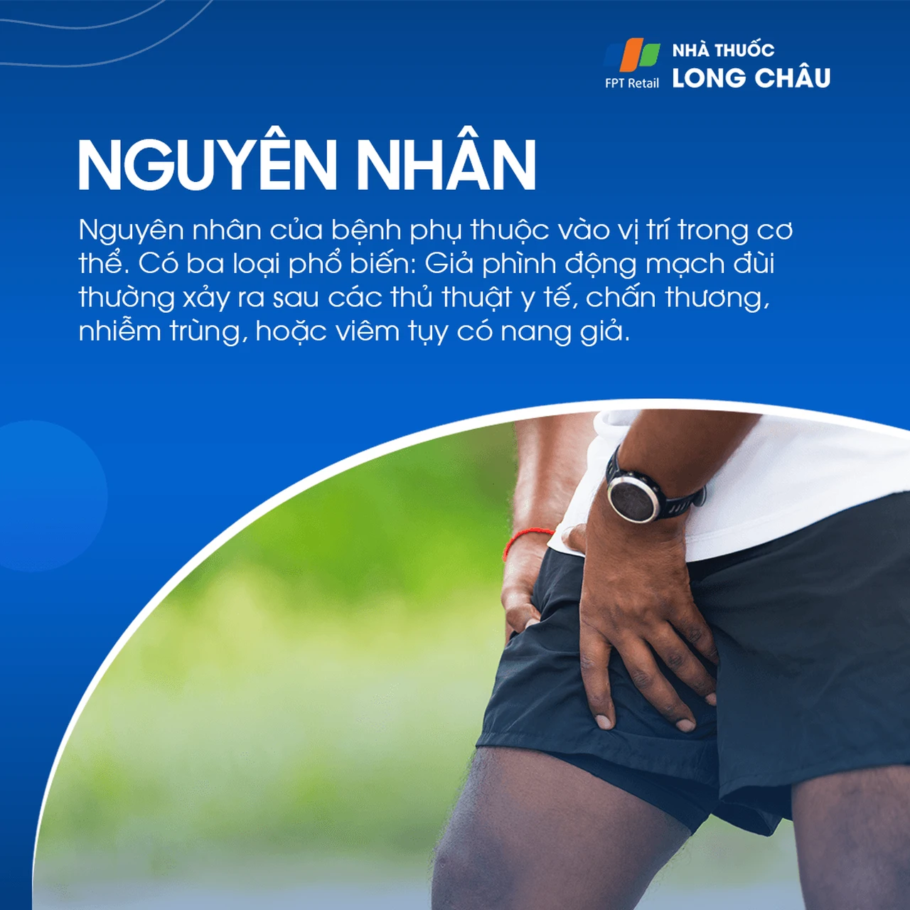 Giả phình mạch 4