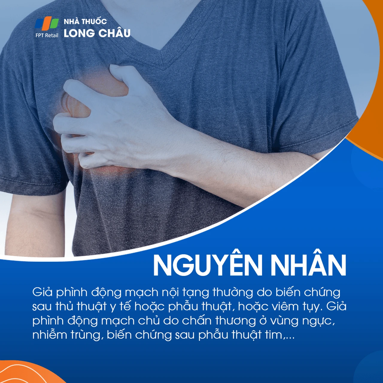 Giả phình mạch 2