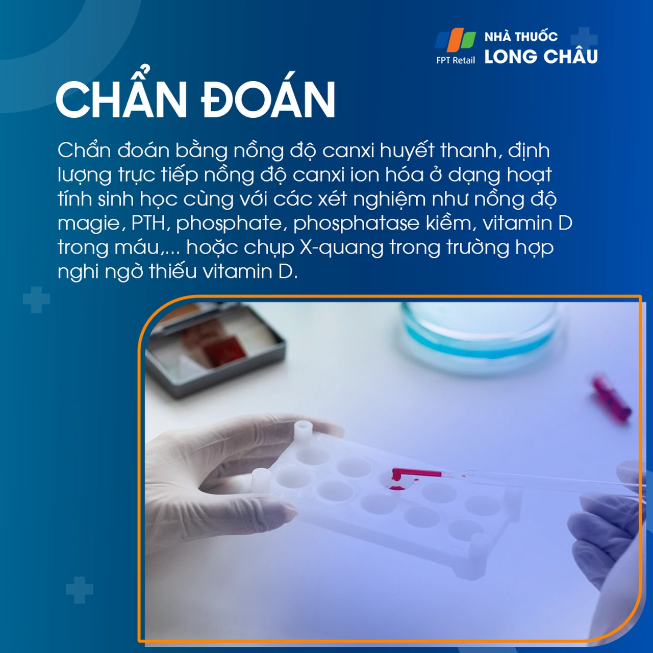 Hạ canxi máu 5