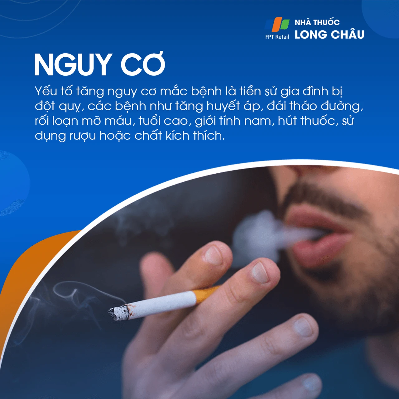 Hẹp động mạch cảnh 4