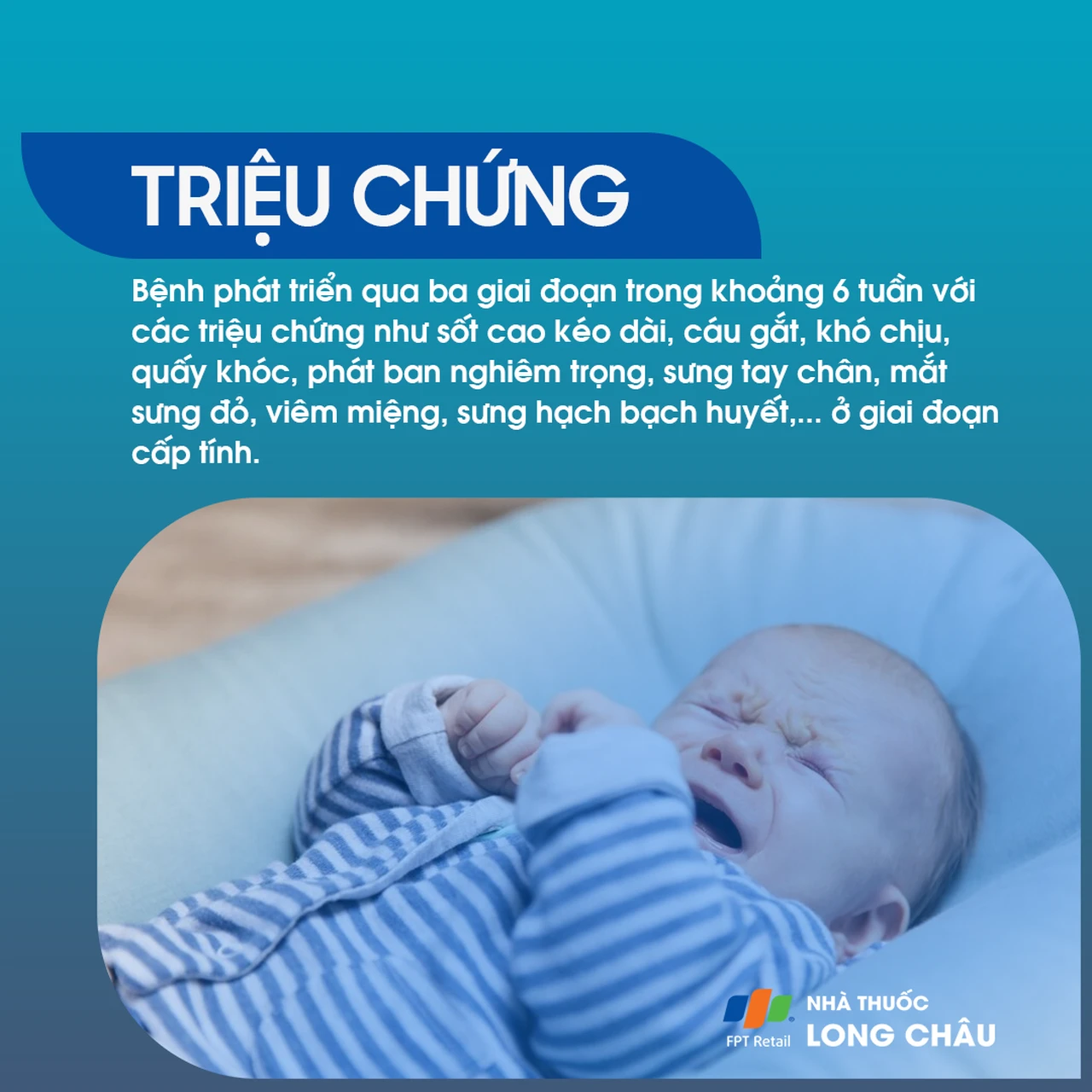 Triệu chứng cấp tính – Trẻ sốt cao kéo dài, quấy khóc, phát ban, sưng tay chân, viêm miệng, sưng hạch bạch huyết