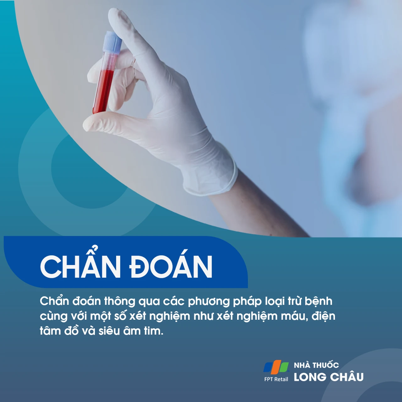Chẩn đoán – Dựa vào loại trừ bệnh, xét nghiệm máu, điện tâm đồ, siêu âm tim