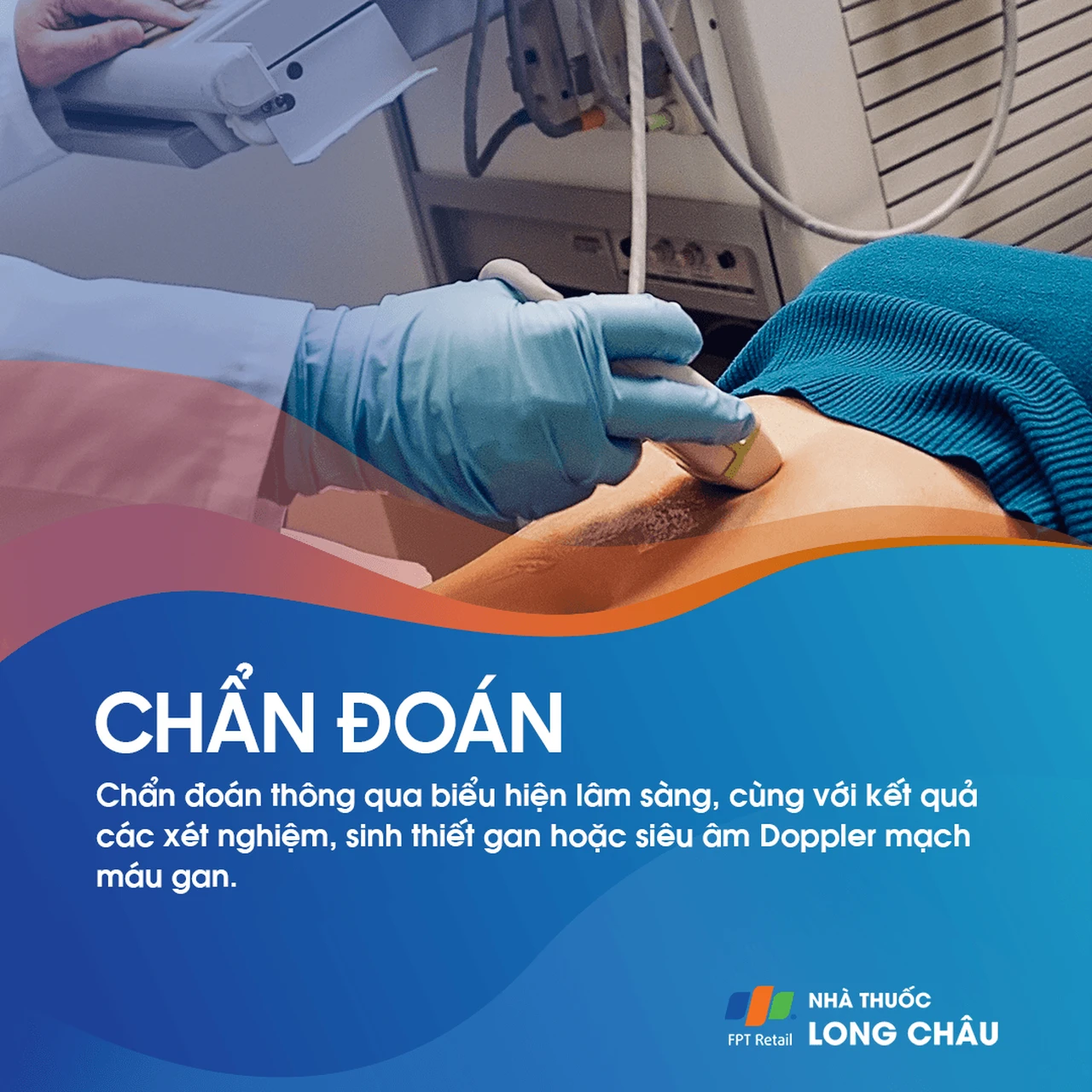 Thiếu máu cục bộ đường mật 5