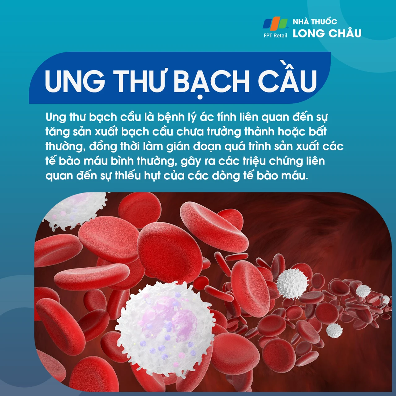 Ung thư bạch cầu 1