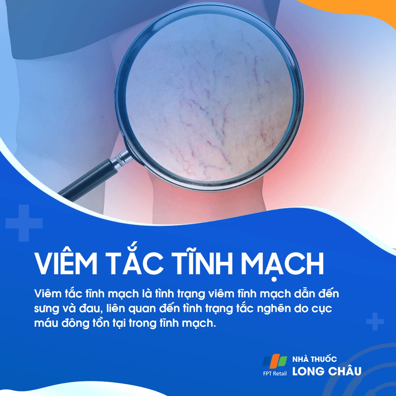 Viêm tắc tĩnh mạch 1