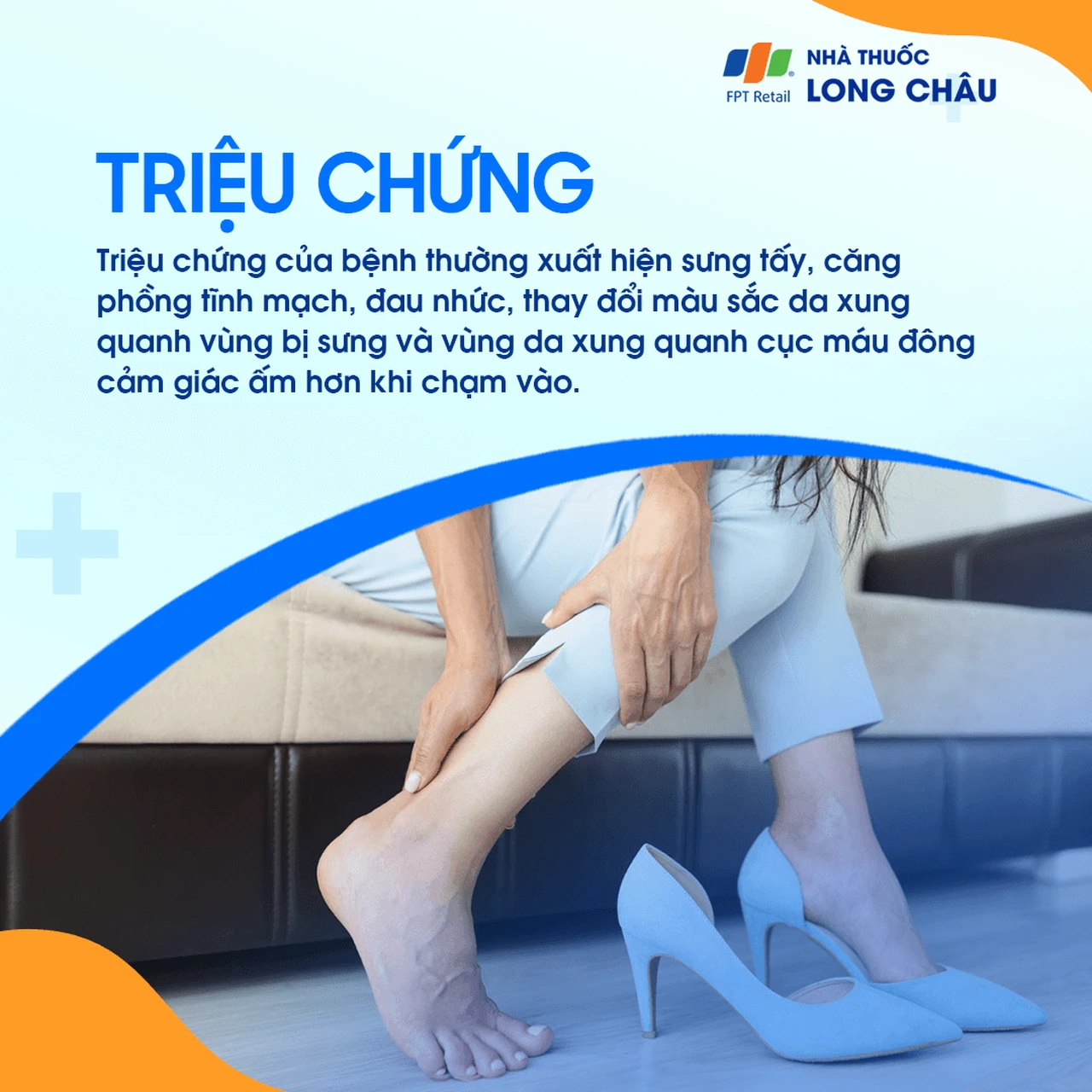 Viêm tắc tĩnh mạch 2