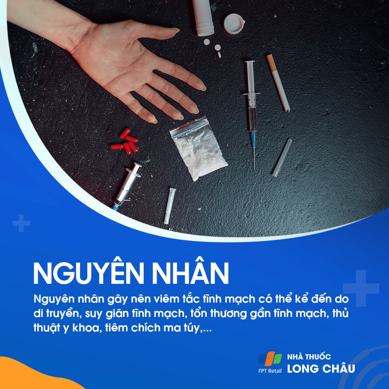 Viêm tắc tĩnh mạch 3