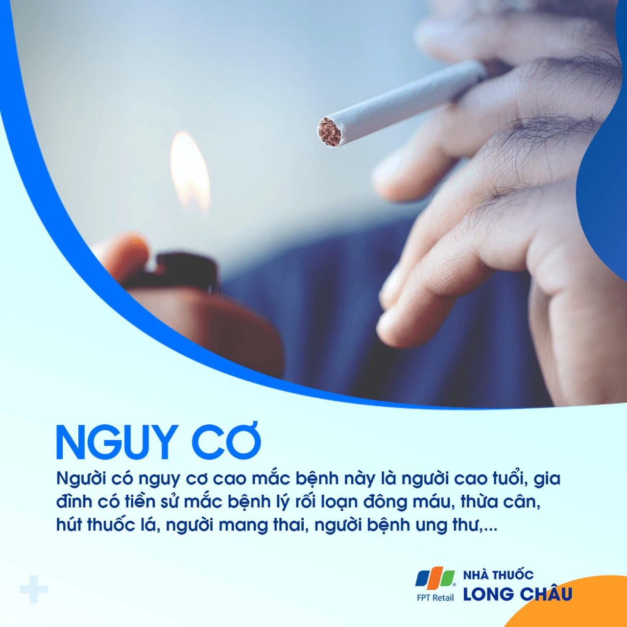 Viêm tắc tĩnh mạch 4